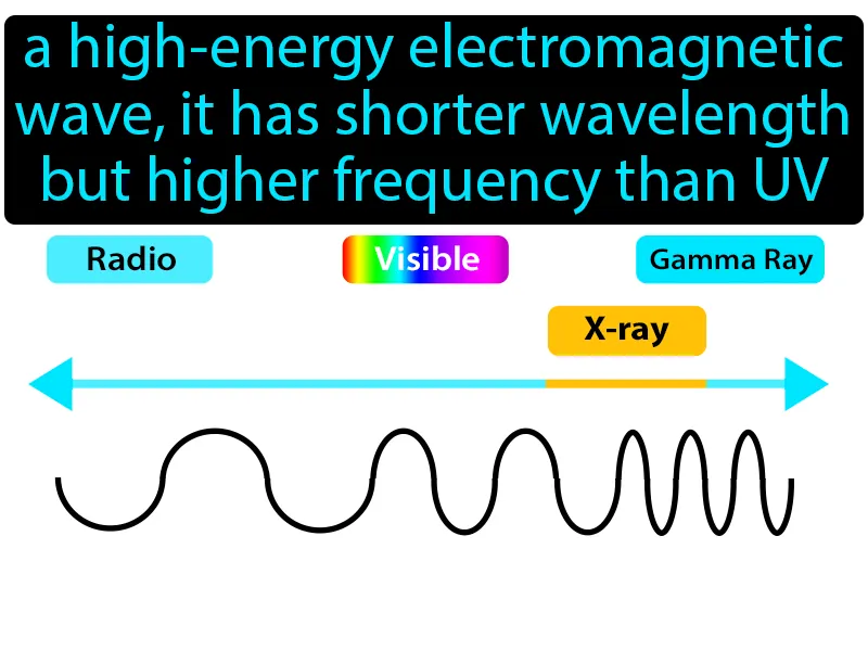 X-Ray Definition X-Ray Definition